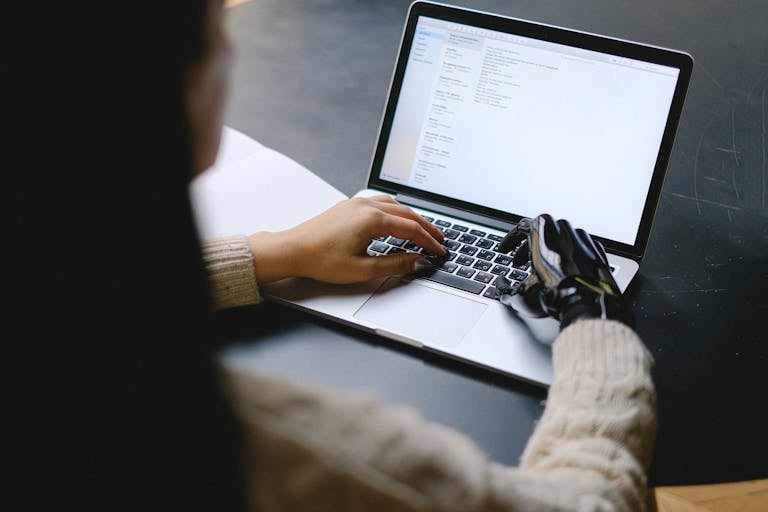 A person with a prosthetic hand using a laptop, showcasing technology and inclusivity, with reference on Legislative Decree 62/2024 about Disability